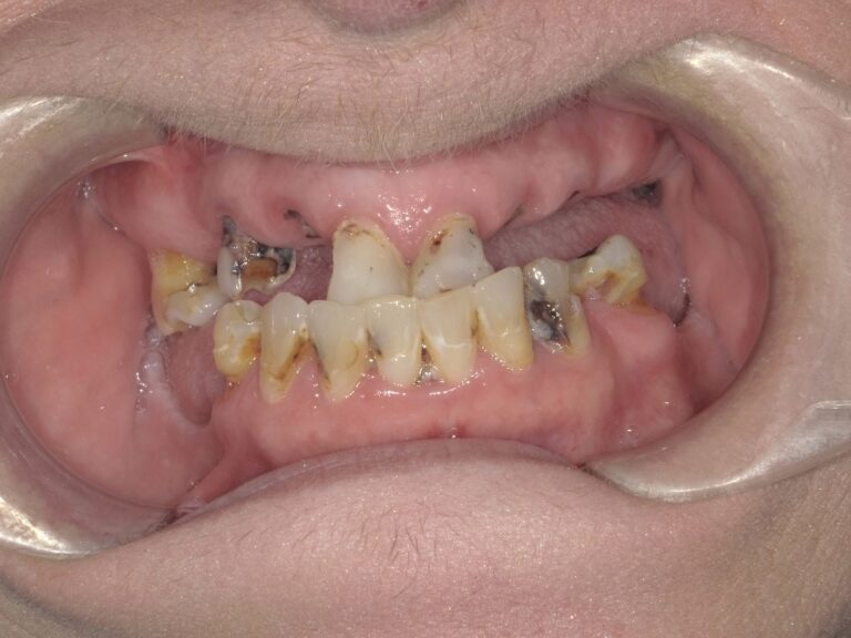 Before Image: All on X - front