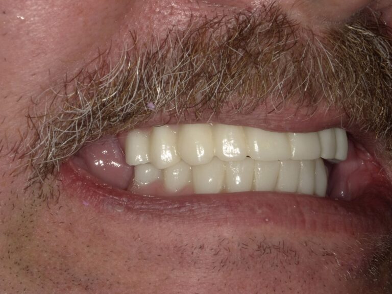 After Image: All on X - right-front-oblique