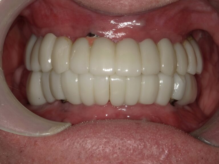 Before Image: 3 on 6 -